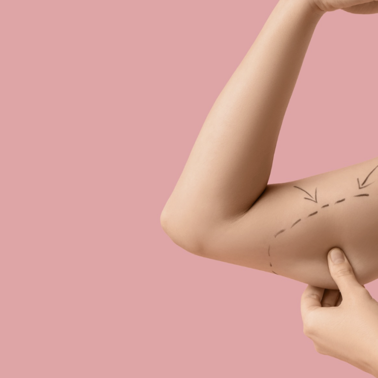 How Much Does Liposuction Cost in Arlington Virginia